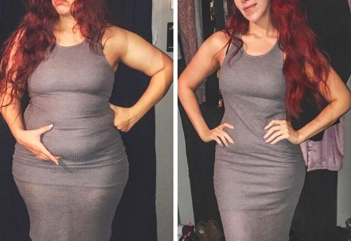 Πριν και μετά τη λήψη Magicoa